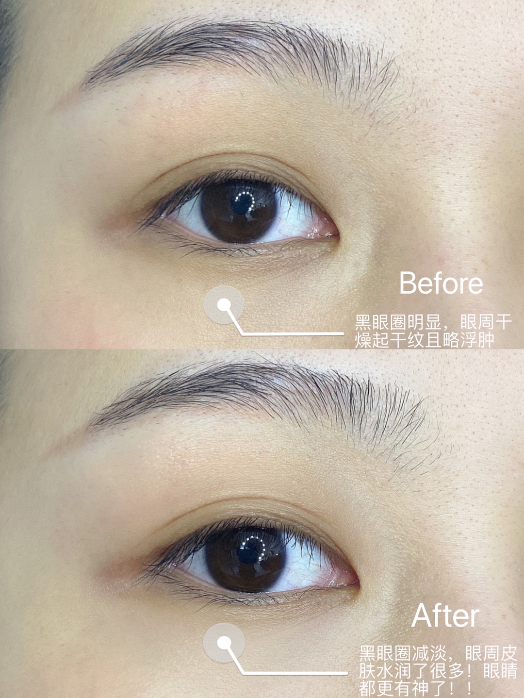 眼霜—Kerrykerry宝贝收到了，刚用肌肤嘟噜嘟噜的喝水，用完之后脸明显变白了，很喜欢